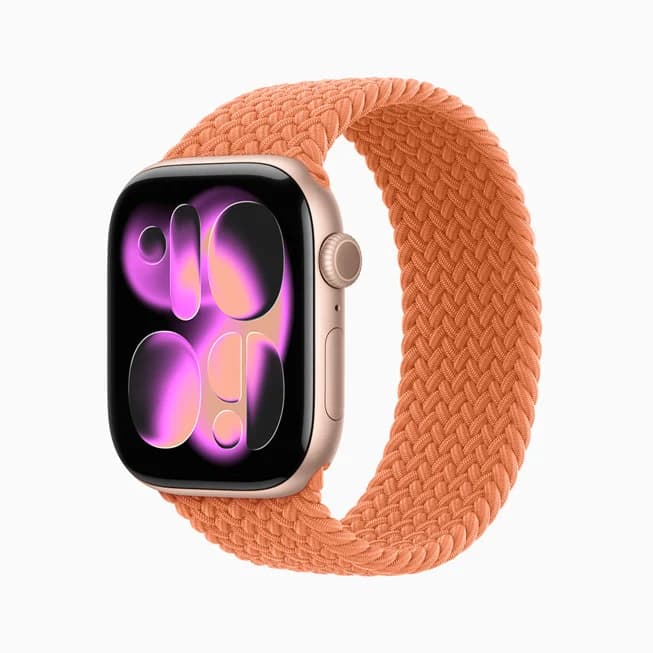Apple Watch Series 11, Розовое золото